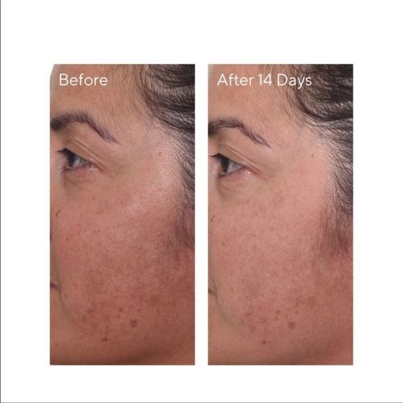 Murad Rapid Dark Spot Correcting Serum - Picture 3 of 12